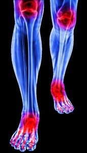 edited foot and ankle for blog